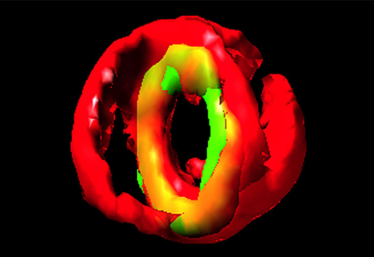 A fluorescence micrograph of S. aureus as it begins the cell division process. The green area shows the assembly of GpsB protein molecules at the site of division.